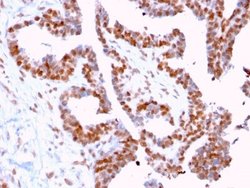 DMC1 Antibody (2H12/4) - Azide and BSA Free, Novus Biologicals 100 &mu;g;